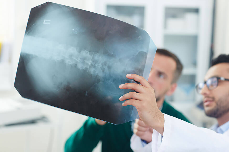 doctor reviewing x-ray of Spinal Cord Injury